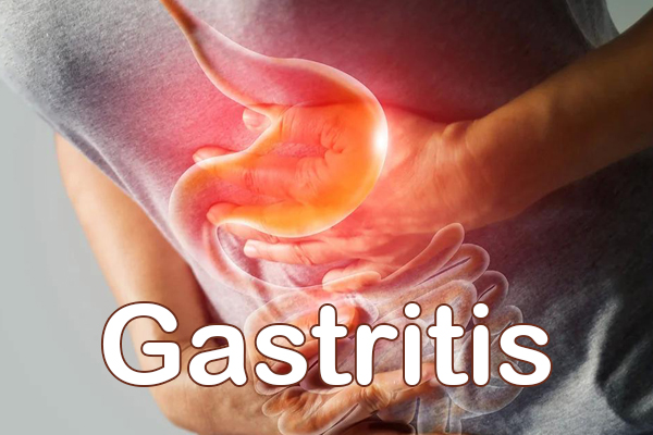 Gastritis2.jpg