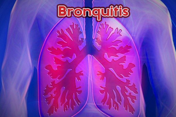 bronquitis2.jpg