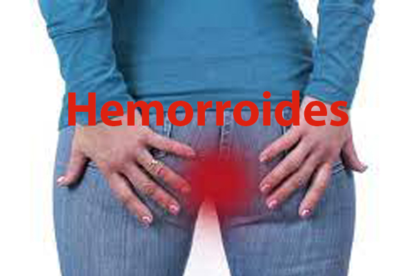hemorroides2.jpg