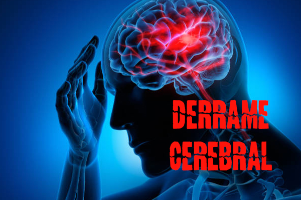 1-derrame-cerebral2.jpg
