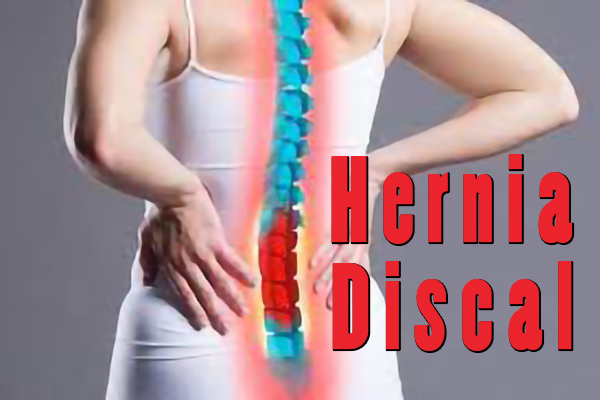 2hernia-discal2.jpg
