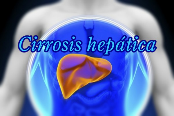 1cirrosis.jpg