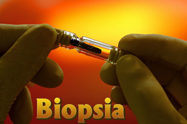 3biopsia.jpg