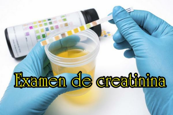 3examen-de-creatinina-2.jpg