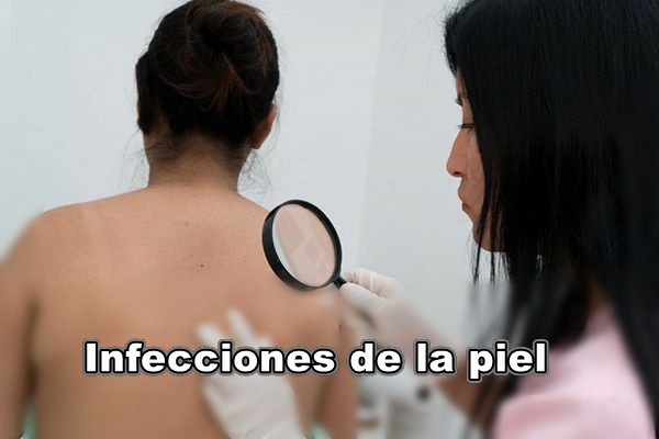 infecciones-en-la-piel-2.jpg