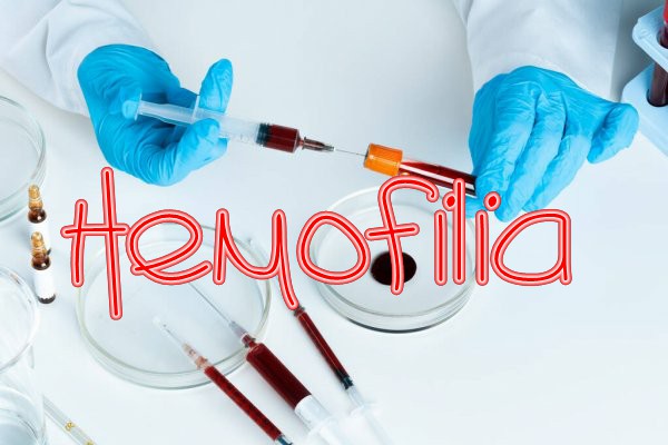 1hemofilia.jpg