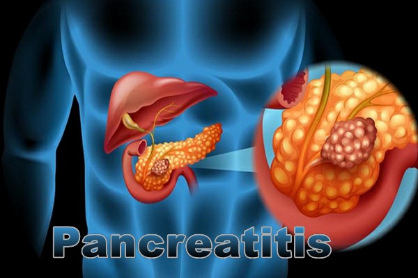 1pancreatitis.jpg