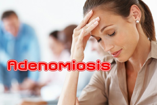 3adenomiosis.jpg