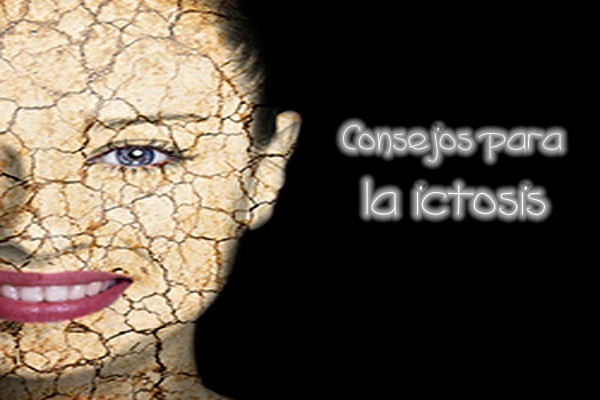 2consejos-ictosis.jpg