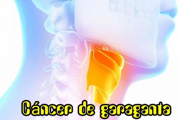 2cancer-de-garaganta.jpg