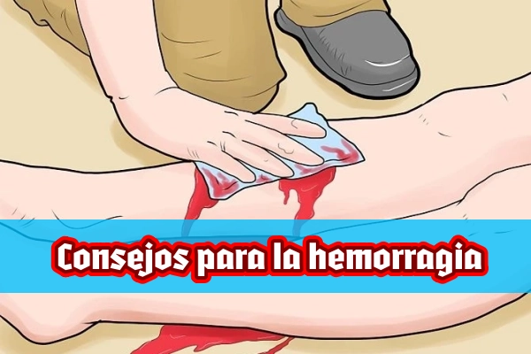 consejos-hemorragia-2.webp