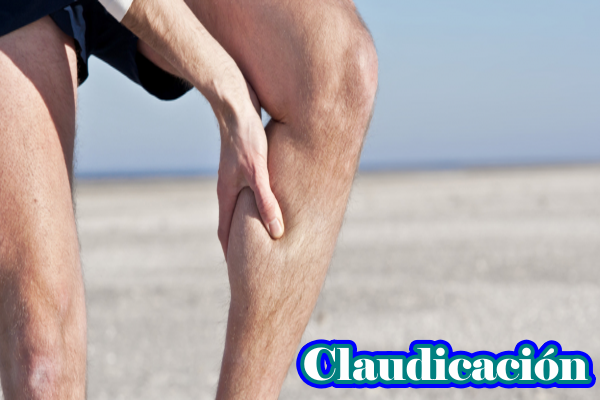 2claudicacion.png