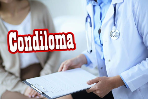 condiloma-2.jpeg