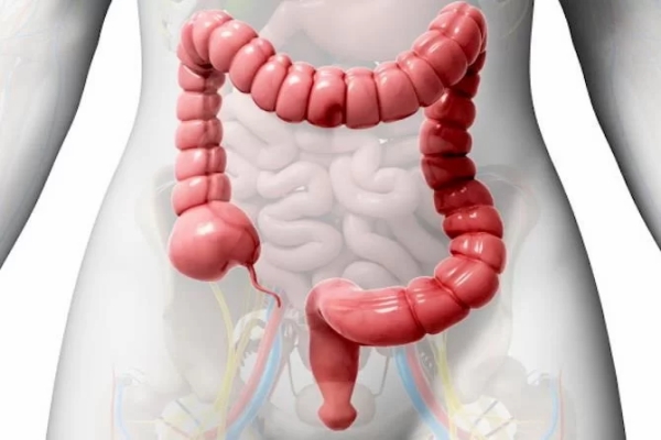 colon-irritable-3.jpg